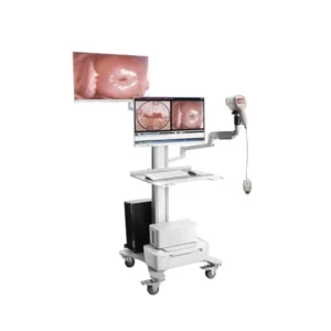 Colposcope Digital imaging System